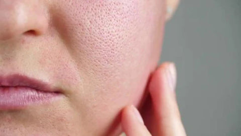 How to minimise pores?