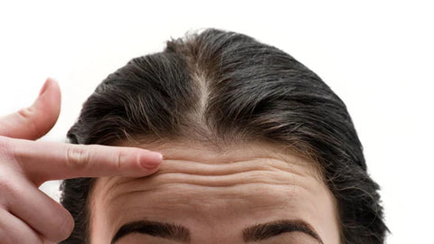 How to reduce and prevent forehead wrinkles